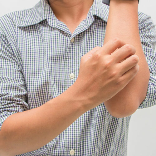 Jock Itch Disease – Its Symptoms, Causes, and Diagnoses