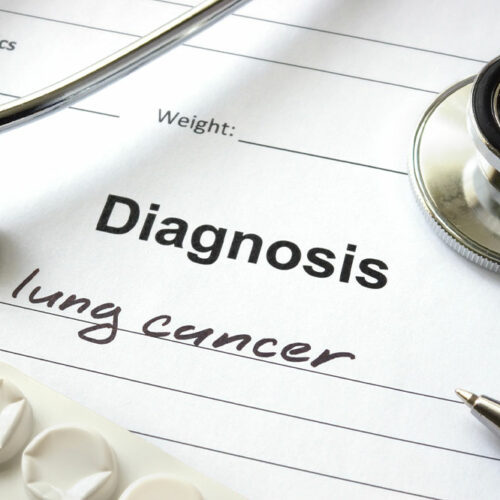 Lung Cancer – Types, Causes, and Symptoms