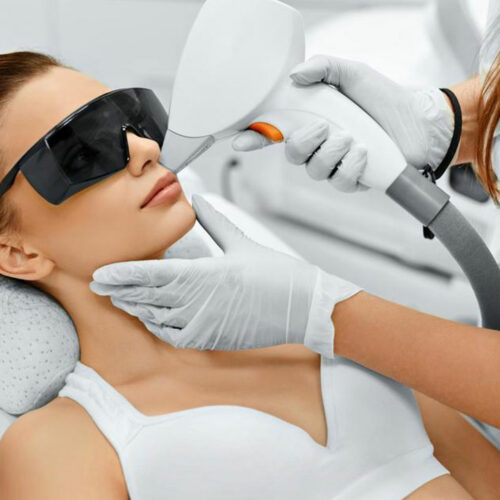 Laser hair removal – What to expect