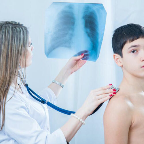 Pneumococcal Pneumonia – Symptoms, Treatment, and More