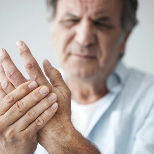 Rheumatoid arthritis – What is it and how to live healthy